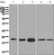 RNA Binding Motif Protein 3 antibody, ab134946, Abcam, Western Blot image 