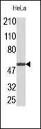 DnaJ Heat Shock Protein Family (Hsp40) Member B1 antibody, 251864, Abbiotec, Western Blot image 