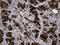 Ribonucleotide Reductase Regulatory Subunit M2 antibody, LS-C795471, Lifespan Biosciences, Immunohistochemistry paraffin image 