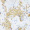 Elastin antibody, STJ114307, St John