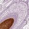 Keratin 81 antibody, NBP2-57133, Novus Biologicals, Immunohistochemistry paraffin image 