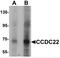 Coiled-Coil Domain Containing 22 antibody, NBP2-81708, Novus Biologicals, Western Blot image 