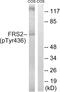 Fibroblast Growth Factor Receptor Substrate 2 antibody, abx012649, Abbexa, Western Blot image 