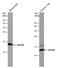 Ubiquinol-Cytochrome C Reductase Binding Protein antibody, PA5-78216, Invitrogen Antibodies, Western Blot image 