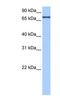 Adenosine Deaminase Domain Containing 2 antibody, NBP1-57511, Novus Biologicals, Western Blot image 