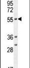 Cytochrome P450 Family 2 Subfamily A Member 7 antibody, PA5-23979, Invitrogen Antibodies, Western Blot image 