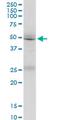Formin 1 antibody, MA5-24537, Invitrogen Antibodies, Western Blot image 