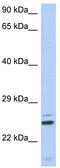 Tetratricopeptide Repeat Domain 9C antibody, TA331417, Origene, Western Blot image 