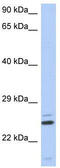 Tetratricopeptide Repeat Domain 9C antibody, TA331417, Origene, Western Blot image 