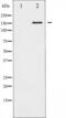 Rho Associated Coiled-Coil Containing Protein Kinase 1 antibody, TA325814, Origene, Western Blot image 