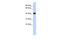 Alcohol Dehydrogenase 4 (Class II), Pi Polypeptide antibody, PA5-42387, Invitrogen Antibodies, Western Blot image 