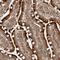 Cell Cycle Progression 1 antibody, HPA026861, Atlas Antibodies, Immunohistochemistry paraffin image 
