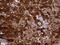 Carbonyl Reductase 1 antibody, M02825-1, Boster Biological Technology, Immunohistochemistry paraffin image 