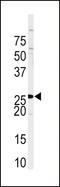 Sprouty RTK Signaling Antagonist 4 antibody, LS-B9112, Lifespan Biosciences, Western Blot image 