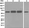 Insulin Like Growth Factor 2 MRNA Binding Protein 2 antibody, ab124930, Abcam, Western Blot image 