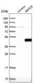 Abhydrolase Domain Containing 5 antibody, NBP1-84506, Novus Biologicals, Western Blot image 