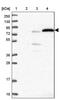 Exocyst Complex Component 3 Like 4 antibody, PA5-60455, Invitrogen Antibodies, Western Blot image 
