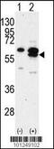 Calcium/calmodulin-dependent protein kinase type 1G antibody, 62-763, ProSci, Western Blot image 