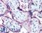 Cytochrome P450 Family 19 Subfamily A Member 1 antibody, LS-C140832, Lifespan Biosciences, Immunohistochemistry paraffin image 