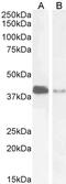 PARD6A antibody, 46-130, ProSci, Immunohistochemistry paraffin image 