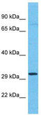 Olfactory Receptor Family 4 Subfamily C Member 11 antibody, TA337502, Origene, Western Blot image 