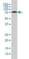 LON Peptidase N-Terminal Domain And Ring Finger 1 antibody, H00091694-M01, Novus Biologicals, Western Blot image 