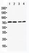 Melanoma Cell Adhesion Molecule antibody, PA1736, Boster Biological Technology, Western Blot image 