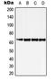 Zinc Finger Protein 460 antibody, LS-C353274, Lifespan Biosciences, Western Blot image 