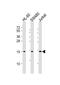 Metastasis-suppressor KiSS-1 antibody, GTX01566, GeneTex, Western Blot image 