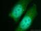 NIMA Related Kinase 9 antibody, 11192-1-AP, Proteintech Group, Immunofluorescence image 
