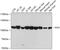 Glucosidase Alpha, Acid antibody, GTX66501, GeneTex, Western Blot image 