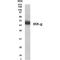 Colony Stimulating Factor 1 antibody, GTX18640, GeneTex, Western Blot image 