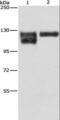 Integrin Subunit Beta 1 antibody, LS-C400827, Lifespan Biosciences, Western Blot image 