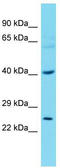Transcription Factor Dp-2 antibody, TA329626, Origene, Western Blot image 