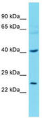 Transcription Factor Dp-2 antibody, TA329626, Origene, Western Blot image 