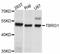 Transforming growth factor beta regulator 1 antibody, A11844, ABclonal Technology, Western Blot image 