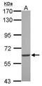 Serum/Glucocorticoid Regulated Kinase Family Member 3 antibody, GTX105604, GeneTex, Western Blot image 