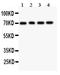 Forkhead Box O1 antibody, PB9195, Boster Biological Technology, Western Blot image 