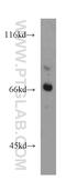 Carboxylesterase 3 antibody, 14587-1-AP, Proteintech Group, Western Blot image 