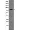 G Protein-Coupled Receptor Kinase 2 antibody, PA5-64756, Invitrogen Antibodies, Western Blot image 