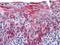 Keratin 15 antibody, MA5-15567, Invitrogen Antibodies, Immunohistochemistry paraffin image 
