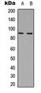 Microtubule Affinity Regulating Kinase 2 antibody, LS-C356174, Lifespan Biosciences, Western Blot image 