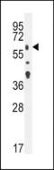 Transforming Growth Factor Beta Receptor 2 antibody, TA324439, Origene, Western Blot image 