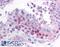 MAGE Family Member B2 antibody, LS-B889, Lifespan Biosciences, Immunohistochemistry paraffin image 