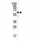 Integrin Linked Kinase antibody, F40141-0.4ML, NSJ Bioreagents, Western Blot image 