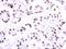HNF1 Homeobox B antibody, GTX129236, GeneTex, Immunohistochemistry paraffin image 