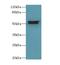 Aldehyde Dehydrogenase 1 Family Member A1 antibody, LS-C375189, Lifespan Biosciences, Western Blot image 