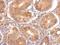 Alpha Tocopherol Transfer Protein antibody, NBP2-14870, Novus Biologicals, Immunohistochemistry paraffin image 