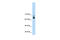 Metastasis Associated 1 Family Member 2 antibody, 29-893, ProSci, Western Blot image 