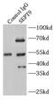 Eseptin antibody, FNab07729, FineTest, Immunoprecipitation image 